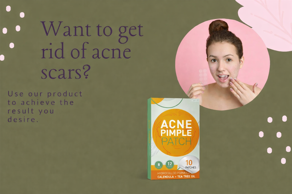 Acne Pimple Patch (pack of 10)