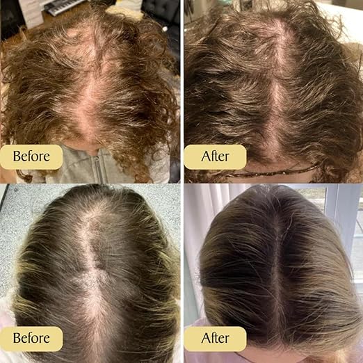 Veganic Natural Hair Growth Oil Pack Of 1
