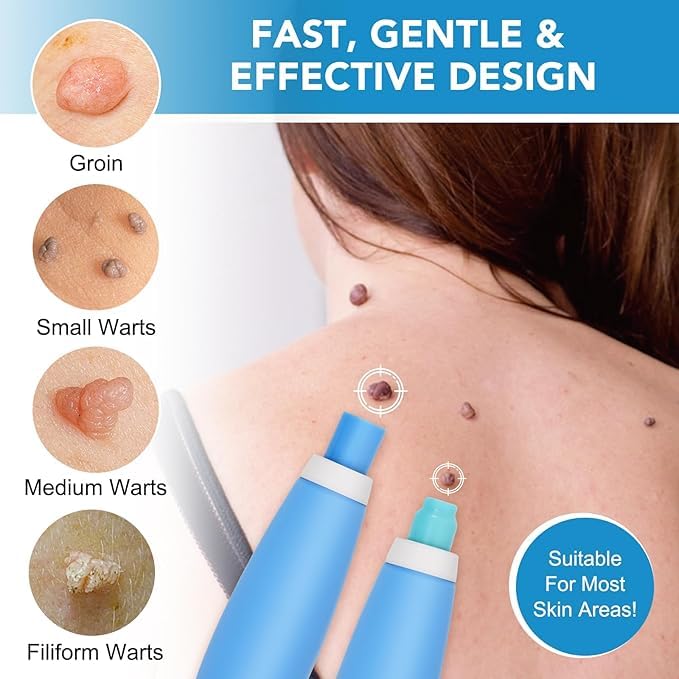 Auto Skin Tag Remover Kit for Face & Body Upgraded Fast and Easy Removal Pen with 40 Removal Bands & 10 Cleansing Wipes