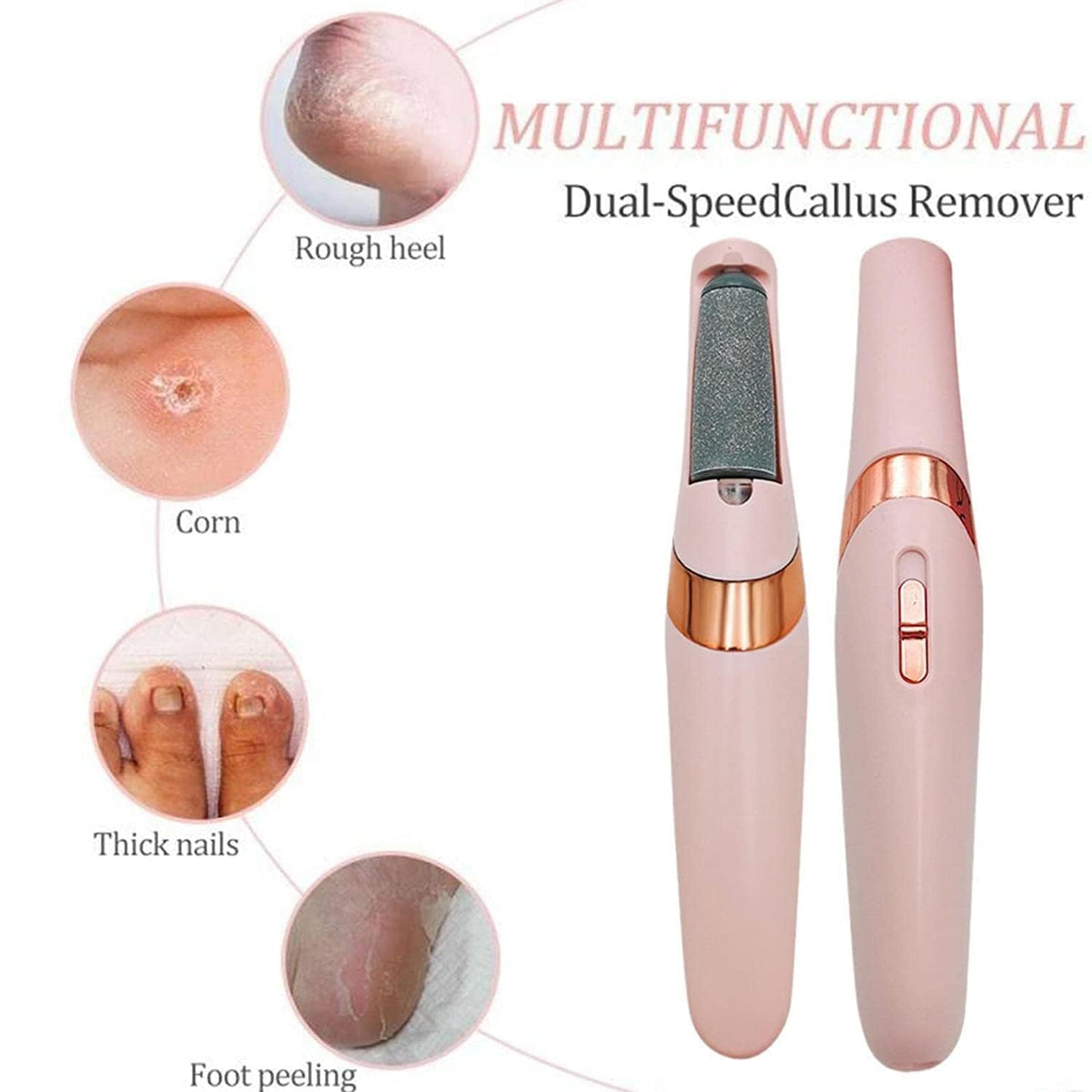 Hanglow Electric Callus Remover for Feet – Rechargeable Foot Dead Skin Remover with 2 Roller Heads PACK OF 1