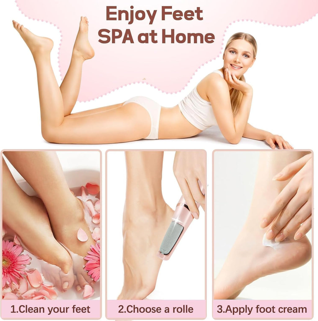 Hanglow Electric Callus Remover for Feet – Rechargeable Foot Dead Skin Remover with 2 Roller Heads PACK OF 1