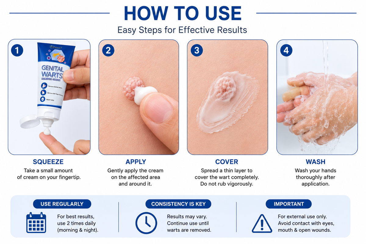 Gentle Warts Remover Cream Pack Of 1