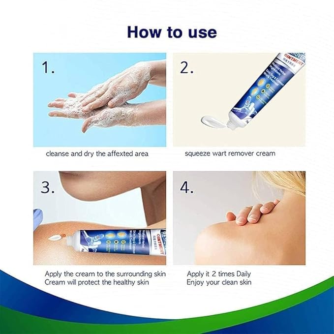 Wart Remover Ointment PACK OF 2