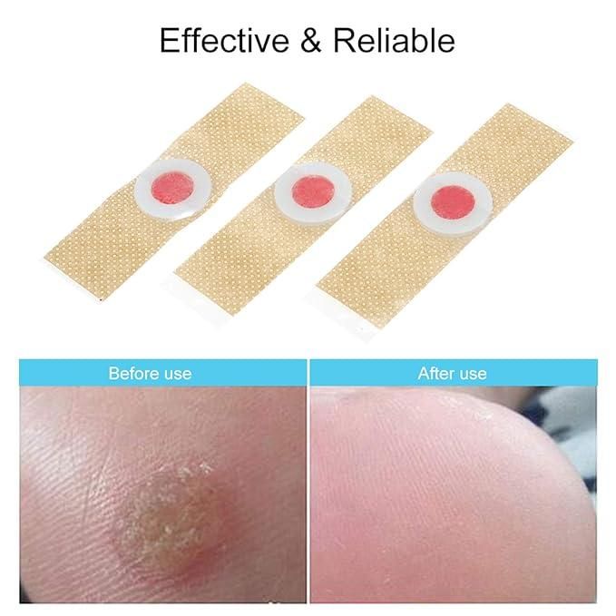 Corn Remover Pads Pack of PACK OF 2