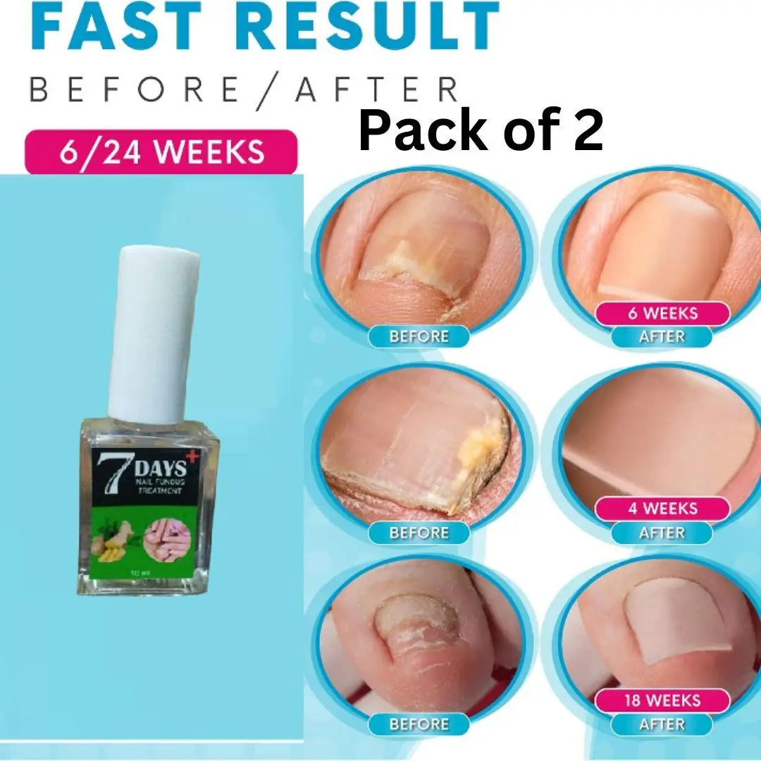 AI Nail Fungus Repair Polish pack of 2