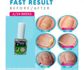 Nial Treatment Polish