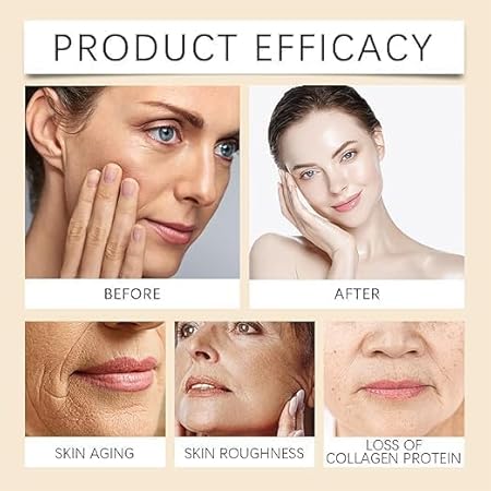 BOTOX CREAM 60 GM(PACK OF 1)