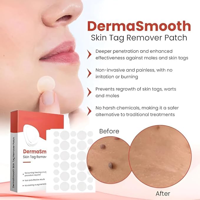 Derma Smooth Skin Tag Removal Patches