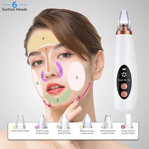 Advanced Blackhead & Whitehead Remover Tool with 6 Suction Heads
