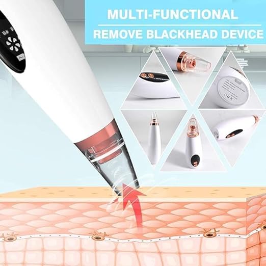 Advanced Blackhead & Whitehead Remover Tool with 6 Suction Heads