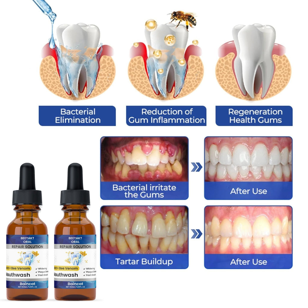 Dental Treatment Drops 50ml each pack of 1