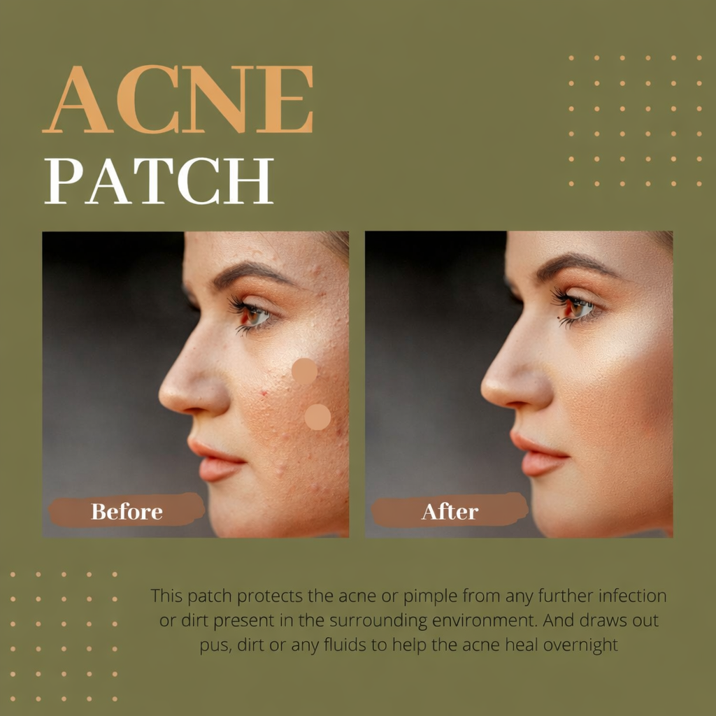 AI Acne Pimple Patch (pack of 20)