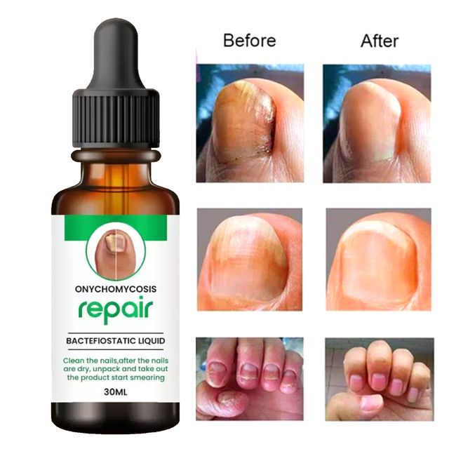 NAIL REPAIR SERUM 30 ML (PACK OF 1)