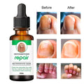 NAIL REPAIR SERUM 30 ML (PACK OF 1)