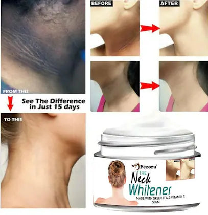 Neck Back Whitening Cream 50 gm