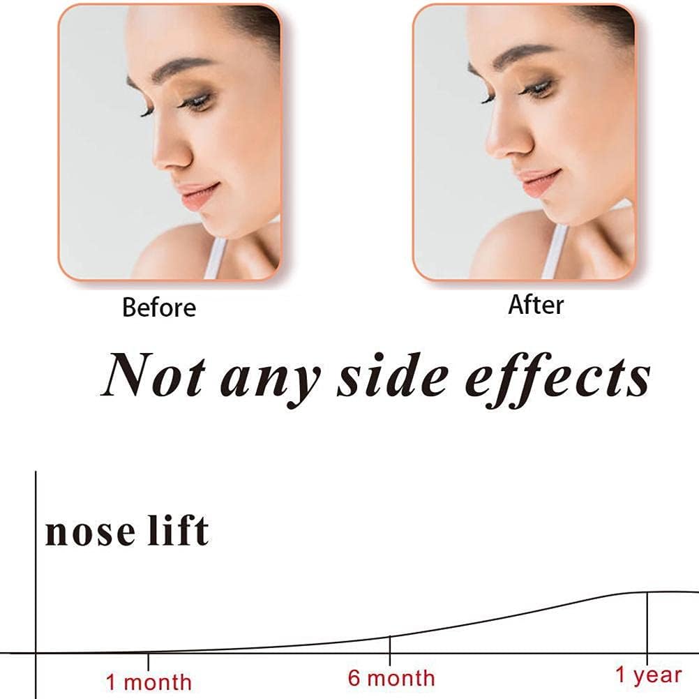 Silicone Nose Shaper Clip PACK OF 1 (MULTICOLOR)