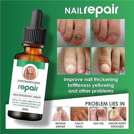 NAIL REPAIR SERUM 30 ML (PACK OF 1)