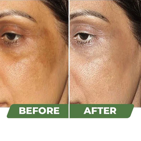 Skin Brightening Cream pack 1