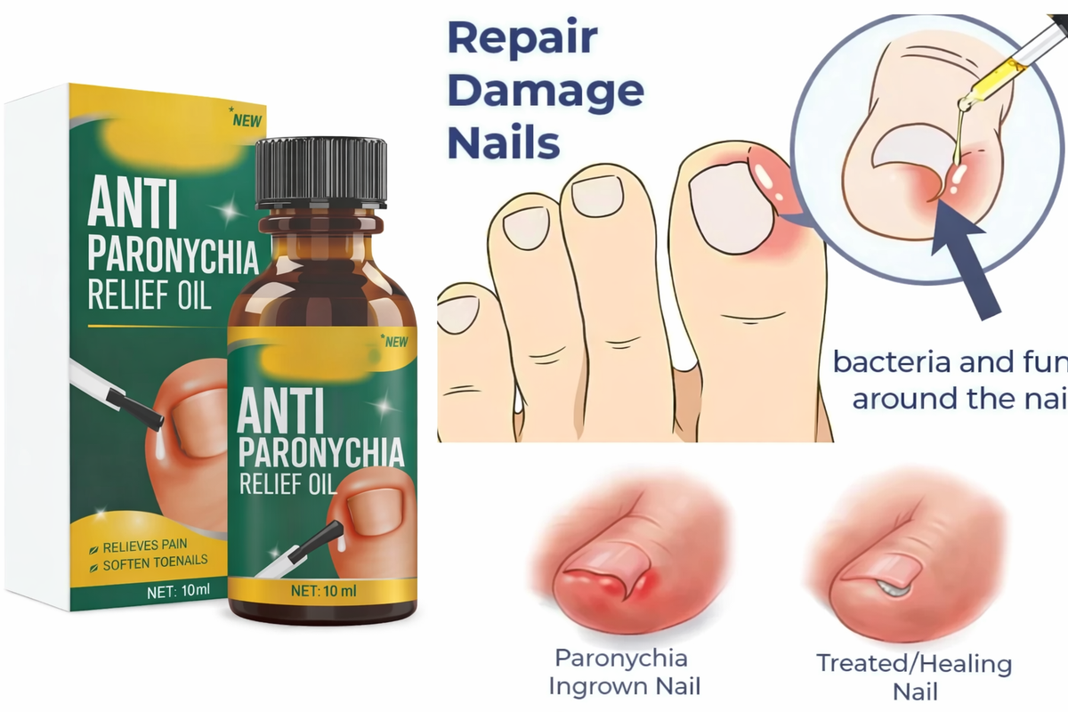 Anti Paronychia Relief Oil, 10mleach, Natural Nail Treatment pack of 2
