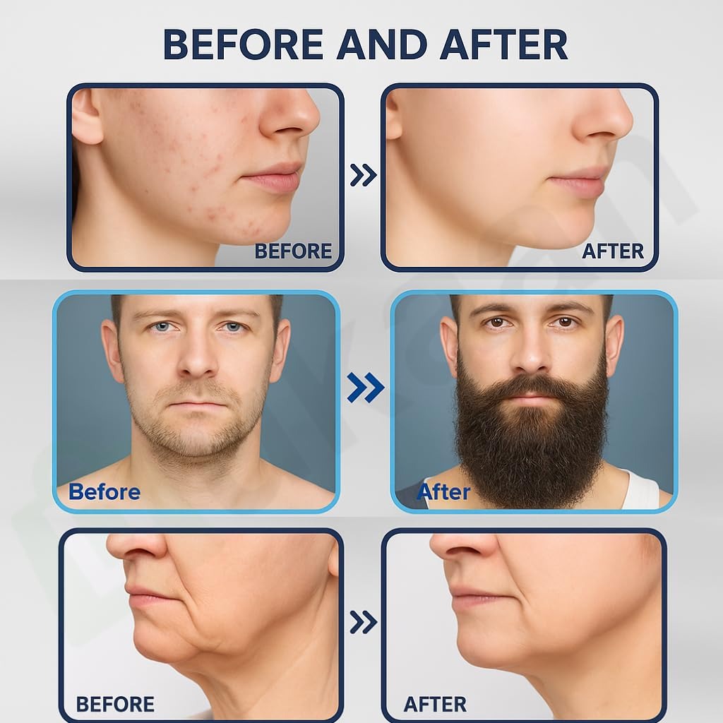 Derma stamp for Hair & Beard regrowth Brand Product  pack of 1