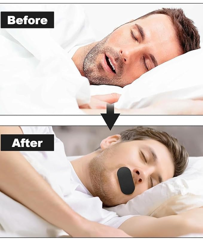 Anti Snoring Nasal Strip Mouth Breathing Stopper Sleeping Mouth Tape for Adults(30Pcs Pack)