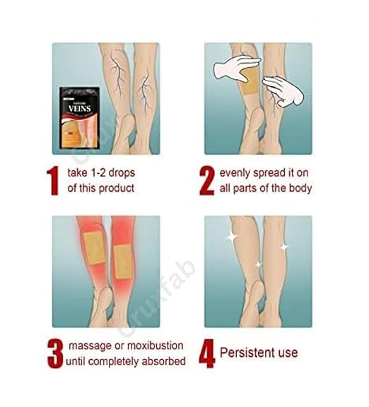 Varicose Veins Health Care  Spray (Pack of 3)