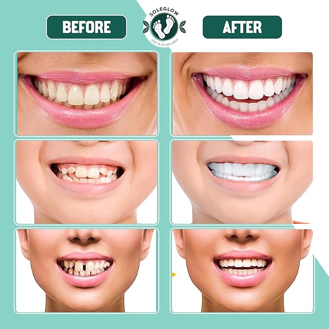 Teeth denture pack of 1