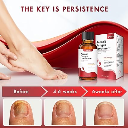 Toenail fungus care solution(pack of 2)